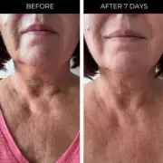 Beauty Bargain: This £18 Neck Serum Is Making Wrinkles and Sagging Skin Disappear