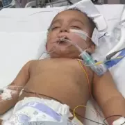 Birmingham Boy's Mouth Sealed Shut After Drinking Deadly Drain Cleaner