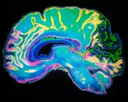 Cambridge Study Reveals 5 Brain Epochs, But Ageing Stages Overlooked