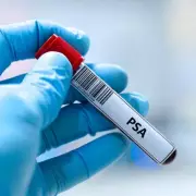 GP Warns: Routine Blood Tests Don't Detect Many Cancers