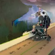 Miracle Woman Born Without Major Brain Part Reveals How She Lives Normal Life