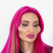 Model with 'world's biggest cheeks' shares rare pre-filler snap