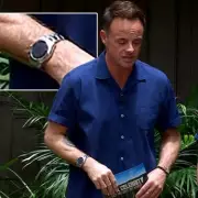 Real Reason Ant and Dec Hide Watches on I'm A Celeb Revealed