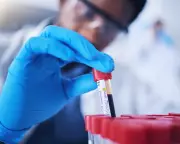 UK Biobank Study Paves Way for Pinprick Tests to Predict Disease 10+ Years Early