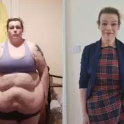 Woman Loses 13.5 Stone Without Surgery: 'I Lost a Full-Grown Man'