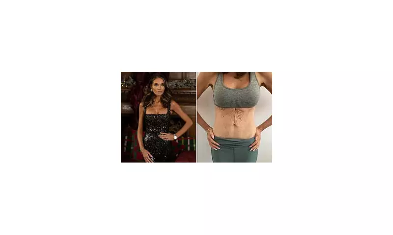 Amy Childs reveals non-surgical tummy transformation after four kids and weight loss