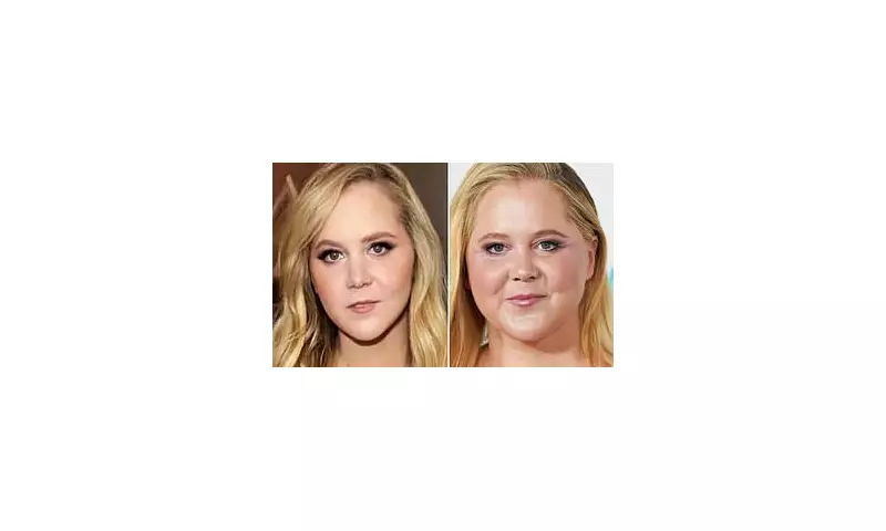 Amy Schumer's Dramatic Transformation: Weight Loss & Wrinkle-Free Face Spark Debate