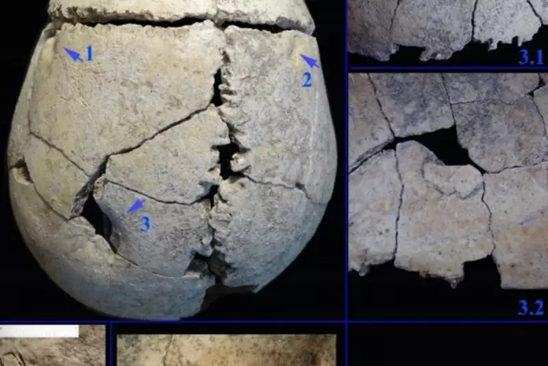 Ancient Teen Survived Lion Attack for Months, Revealing Early Human Compassion