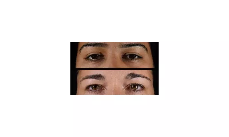 Can You Guess a Woman's Age From Just Her Eyes? Study Reveals Key Clues