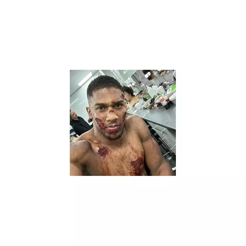 Driver in Anthony Joshua Crash Faces Reckless Driving Prosecution