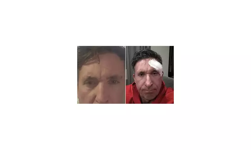 Liverpool Legend Robbie Fowler, 50, Reveals Skin Cancer Operation