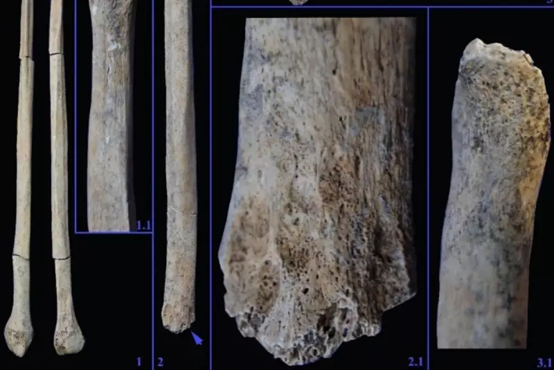 Prehistoric Teenager Survived Lion Attack for Months, Study Reveals