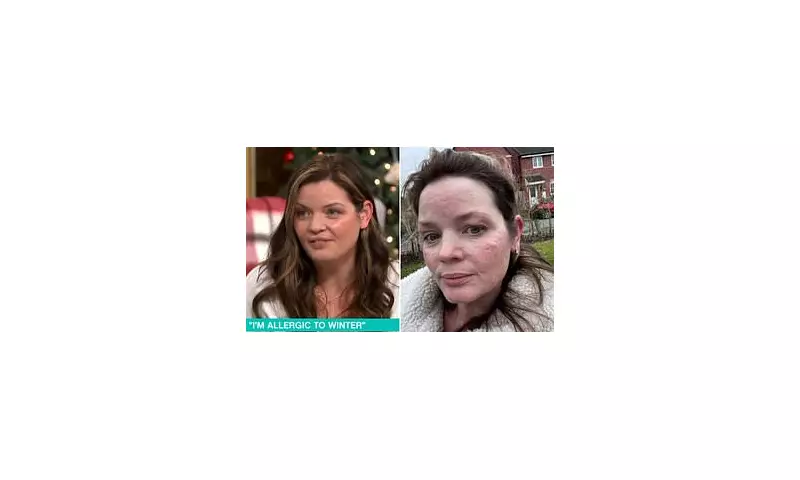 This Morning Guest Reveals Rare Allergy to Cold: 'My Skin Feels Like It's On Fire'