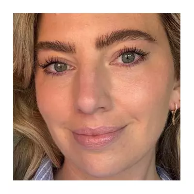 Best Lip Balms for Winter 2024: Top Picks to Beat Chapped Lips