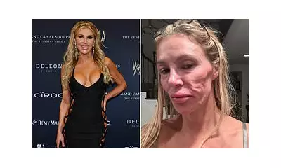 Brandi Glanville's $130k Health Mystery Solved: Diagnosis After Facial Ordeal