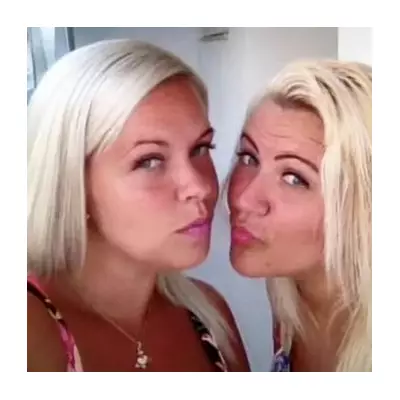 British Mum, 34, Dies After BBL and Tummy Tuck Surgery in Turkey