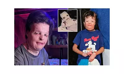 Burn survivor Terry McCarty, 39, overcomes bullying to become firefighter