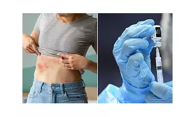 Covid Booster Linked to 21% Higher Shingles Risk, Study Finds