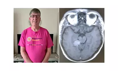 Man's Tinnitus Led to Inoperable Brain Tumour Diagnosis After 2 Years