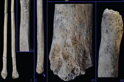 Prehistoric Teenager Survived Lion Attack for Months, Study Reveals