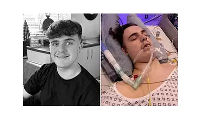 Teen's 'Migraines' Dismissed for a Year Turn Out to Be Inoperable Brain Tumour
