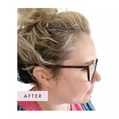 Trichologist-Backed Hair Loss Tablets at 70p a Day Show 'Game-Changing' Results