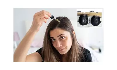 Tropical Plant Serum Boosts Hair Growth by 101% in 8-Week Trial