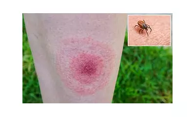 US Congress Demands Probe Into Cold War Tick Bioweapon Claims