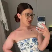 Actress, 21, gets tongue cancer tattoo from arm in NHS reconstructive surgery