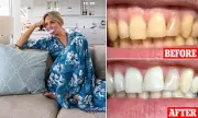 Australian Dentist's Whitening Kit Wins UK Fans: 8 Shades Whiter in 7 Days
