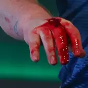 Cameron Menzies' Bloody Meltdown: Darts Star Punches Table After Ally Pally Defeat