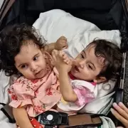 Conjoined Twin Aruna Dies 7 Months After 19-Hour Separation Surgery