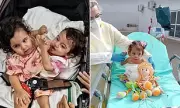Conjoined Twin Aruna Dies Months After 19-Hour Separation Surgery