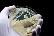 Deadly 'Super Fungus' Candida Auris Spreads to 27 US States