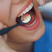 Dentist's Festive Warning: How Prosecco Damages Enamel & Causes Yellow Teeth