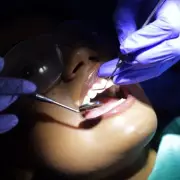 Dentist's Quick Tip: Do This One Thing After Eating for Healthier Teeth