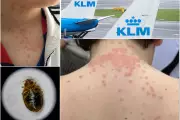 Family Sues KLM and Delta for $200k Over Bed Bug Nightmare on Flight