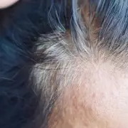 Hair Dye Mistake Adds Decades: Expert Warns Against Dark Colours for Thinning Hair