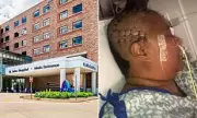 Hospital 'lost patient's skull' and offered $25 gift card as compensation