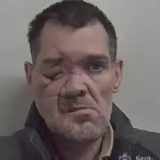 Kent burglar flees hospital with life-changing injury, jailed for 6 years 9 months