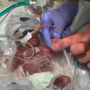 Miracle Baby Born at 22 Weeks, Weighing 1lb, Defies All Odds to Survive