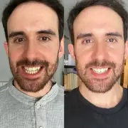 MySweetSmile Teeth Whitening Strips Slashed to £9.99 for Festive Season