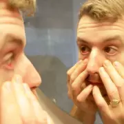 NHS Alert: Unusual Pallor Could Signal 'Silent Killer' Leukaemia