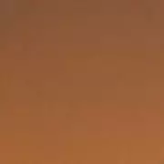 Simon Cowell Reveals Cosmetic Procedures: 'Botox is as Normal as Toothpaste'