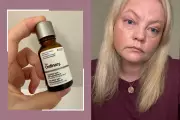 The Ordinary's 'Filler in a Bottle' Serum Tested: My Results in My 40s