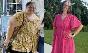 Weight-Loss Surgery Proves 5x More Effective Than GLP-1 Drugs, Study Finds