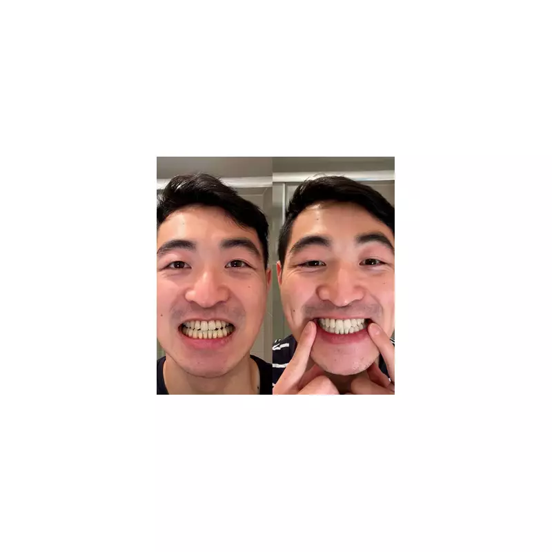 45-year-old man regains smile confidence with 42p-a-day teeth whitening fix