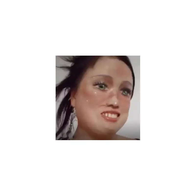 Acid Attack Survivor's Makeup Defiance: 'I Draw My Eyes On Now'