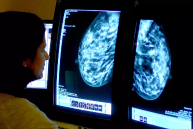 AI Mammography Trial Shows 27% Drop in Aggressive Breast Cancers