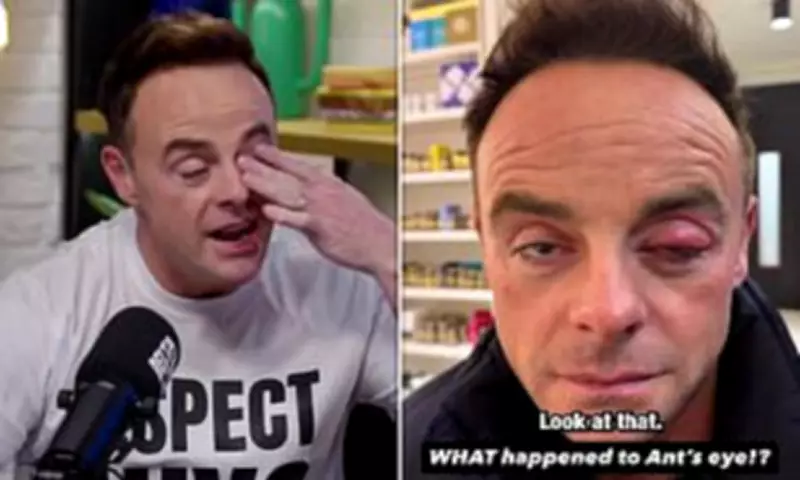 Ant McPartlin Jokes He 'Needs To Cry More' After Blocked Tear Duct Causes Swollen Eye